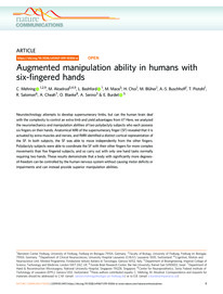 Augmented manipulation ability in humans with six-fingered hands